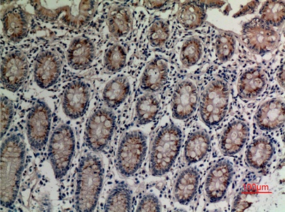 Fig.2. Immunohistochemical analysis of paraffin-embedded human-colon, antibody was diluted at 1:100.