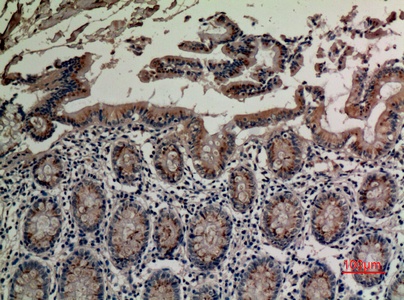 Fig.3. Immunohistochemical analysis of paraffin-embedded human-colon, antibody was diluted at 1:100.