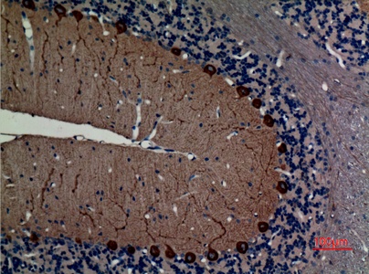 Fig.2. Immunohistochemical analysis of paraffin-embedded rat-brain, antibody was diluted at 1:100.