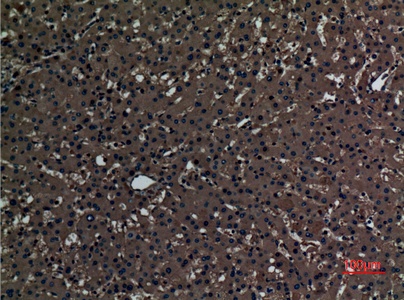 Fig.2. Immunohistochemical analysis of paraffin-embedded human-liver, antibody was diluted at 1:100.