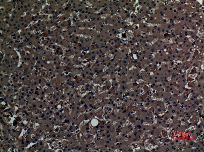 Fig.3. Immunohistochemical analysis of paraffin-embedded human-liver, antibody was diluted at 1:100.