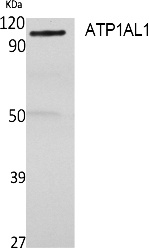 Fig. Western Blot analysis of extracts from rat stomach, using ATP1AL1 Polyclonal Antibody. Secondary antibody (catalog#: A21020) was diluted at 1:20000.