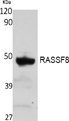 Fig. Western Blot analysis of extracts from rat stomach, using RASSF8 Polyclonal Antibody. Secondary antibody (catalog#: A21020) was diluted at 1:20000.