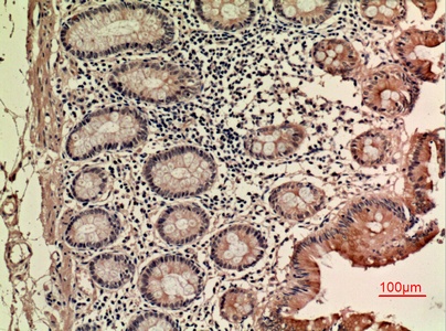 Fig.2. Immunohistochemical analysis of paraffin-embedded human-colon, antibody was diluted at 1:100.