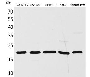 Fig.1. Western Blot analysis of 22RV-1,  SW480, BT474, K562,  Mouse liver cells using VEGF-A Polyclonal Antibody. Antibody was diluted at 1:500. Secondary antibody (catalog#: A21020) was diluted at 1:20000.