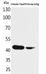 Fig.1. Western Blot analysis of Mouse heart, Mouse lung cells using Actin-α cardiac muscle Polyclonal Antibody. Secondary antibody (catalog#: A21020) was diluted at 1:20000.