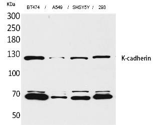 Fig.1. Western Blot analysis of BT474, A549, SHSY5Y, 293 cells using K-cadherin Polyclonal Antibody. Secondary antibody (catalog#: A21020) was diluted at 1:20000.
