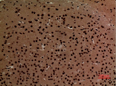Fig.2. Immunohistochemical analysis of paraffin-embedded Mouse-brain, antibody was diluted at 1:100.