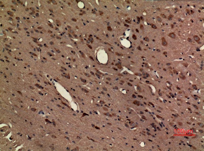 Fig.2. Immunohistochemical analysis of paraffin-embedded rat-brain, antibody was diluted at 1:100.