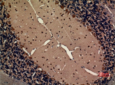 Fig.3. Immunohistochemical analysis of paraffin-embedded rat-brain, antibody was diluted at 1:100.