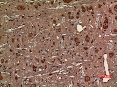 Fig.4. Immunohistochemical analysis of paraffin-embedded rat-brain, antibody was diluted at 1:100.