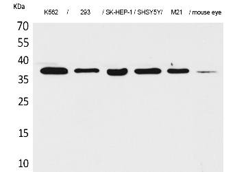 Fig.1. Western Blot analysis of K562,  293, SK-HEP-1,  SHSY5Y, M21,  Mouse eye cells using RRP7A Polyclonal Antibody. Secondary antibody (catalog#: A21020) was diluted at 1:20000.