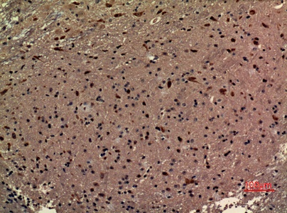 Fig.2. Immunohistochemical analysis of paraffin-embedded Mouse-brain, antibody was diluted at 1:100.