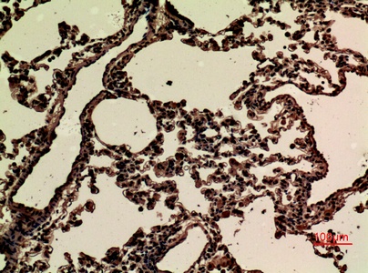 Fig.2. Immunohistochemical analysis of paraffin-embedded rat-lung, antibody was diluted at 1:100.