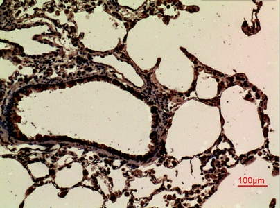 Fig.3. Immunohistochemical analysis of paraffin-embedded rat-lung, antibody was diluted at 1:100.