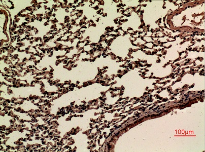 Fig.4. Immunohistochemical analysis of paraffin-embedded Mouse-lung, antibody was diluted at 1:100.