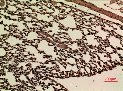 Fig.5. Immunohistochemical analysis of paraffin-embedded Mouse-lung, antibody was diluted at 1:100.