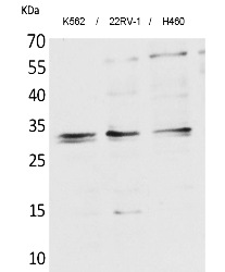 Fig. Western Blot analysis of K562,  22RV-1,  H460 cells using SCP-3 Polyclonal Antibody. Secondary antibody (catalog#: A21020) was diluted at 1:20000.