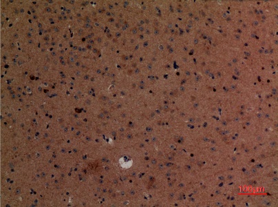 Fig.2. Immunohistochemical analysis of paraffin-embedded Mouse-brain, antibody was diluted at 1:100.