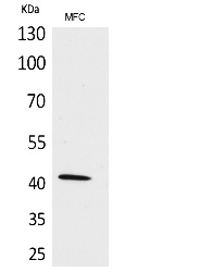Fig.1. Western Blot analysis of MFC cells using α-SMA Polyclonal Antibody. Secondary antibody (catalog#: A21020) was diluted at 1:20000.