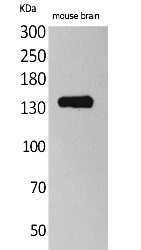 Fig. Western Blot analysis of Mouse brain cells using Contactin 1 Polyclonal Antibody. Secondary antibody (catalog#: A21020) was diluted at 1:20000.