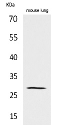 Fig. Western Blot analysis of Mouse lung cells using Chymase Polyclonal Antibody. Secondary antibody (catalog#: A21020) was diluted at 1:20000.