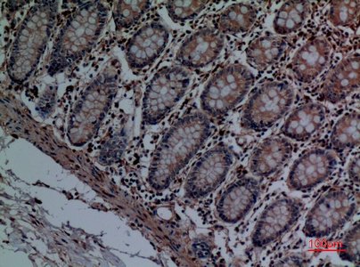 Fig.2. Immunohistochemical analysis of paraffin-embedded human-colon, antibody was diluted at 1:100.