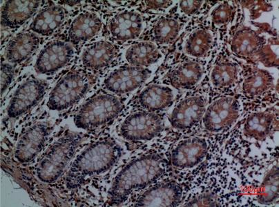 Fig.3. Immunohistochemical analysis of paraffin-embedded human-colon, antibody was diluted at 1:100.