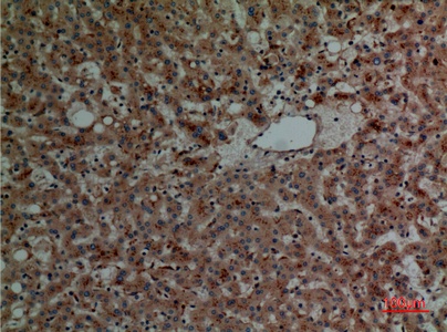 Fig.4. Immunohistochemical analysis of paraffin-embedded human-liver, antibody was diluted at 1:100.
