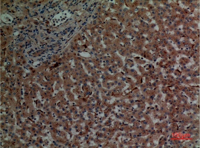 Fig.5. Immunohistochemical analysis of paraffin-embedded human-liver, antibody was diluted at 1:100.
