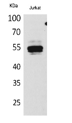 Fig.1. Western Blot analysis of Jurkat cells using DPP7 Polyclonal Antibody. Secondary antibody (catalog#: A21020) was diluted at 1:20000.
