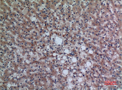 Fig.3. Immunohistochemical analysis of paraffin-embedded human-liver, antibody was diluted at 1:100.
