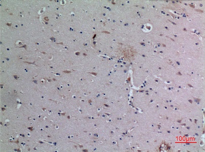 Fig.4. Immunohistochemical analysis of paraffin-embedded human-brain, antibody was diluted at 1:100.