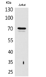 Fig.1. Western Blot analysis of Jurkat cells using Prothrombin Polyclonal Antibody. Secondary antibody (catalog#: A21020) was diluted at 1:20000.