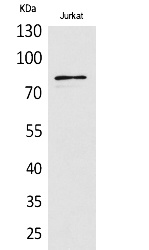 Fig.1. Western Blot analysis of Jurkat cells using PREP Polyclonal Antibody. Secondary antibody (catalog#: A21020) was diluted at 1:20000.
