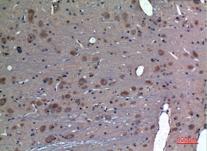Fig.2. Immunohistochemical analysis of paraffin-embedded rat-brain, antibody was diluted at 1:100.