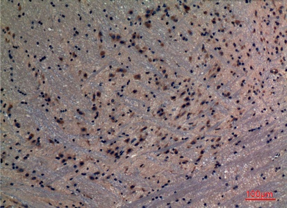 Fig.3. Immunohistochemical analysis of paraffin-embedded Mouse-brain, antibody was diluted at 1:100.