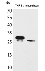 Fig.1. Western Blot analysis of THP-1,  Mouse heart cells using TREM-1 Polyclonal Antibody. Secondary antibody (catalog#: A21020) was diluted at 1:20000.