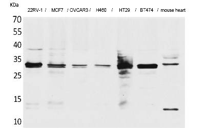 Fig.1. Western Blot analysis of 22RV-1,  MCF7, OVCAR3, H460, HT29, BT474, Mouse heart cells using Latexin Polyclonal Antibody. Secondary antibody (catalog#: A21020) was diluted at 1:20000.
