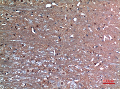 Fig.2. Immunohistochemical analysis of paraffin-embedded rat-brain, antibody was diluted at 1:100.