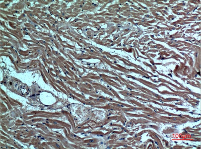 Fig.2. Immunohistochemical analysis of paraffin-embedded human-heart, antibody was diluted at 1:100.