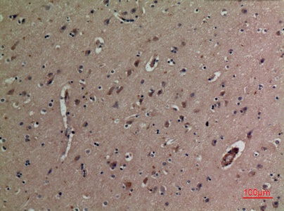 Fig.3. Immunohistochemical analysis of paraffin-embedded human-brain, antibody was diluted at 1:100.