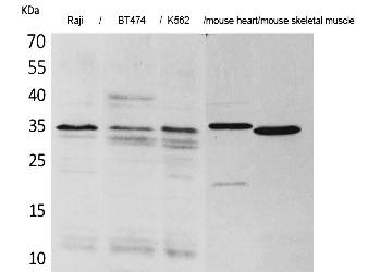 Fig. Western Blot analysis of Raji, BT474, K562,  Mouse heart, Mouse skeletal muscle cells using Claudin-17 Polyclonal Antibody. Secondary antibody (catalog#: A21020) was diluted at 1:20000.