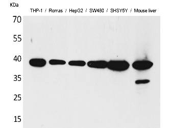 Fig.1. Western Blot analysis of THP-1,  Romas, HepG2,  SW480, SHSY5Y, Mouse liver cells using IL-10 Polyclonal Antibody. Secondary antibody (catalog#: A21020) was diluted at 1:20000.