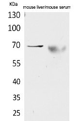 Fig.1. Western Blot analysis of Mouse liver, Mouse serum cells using AFP Polyclonal Antibody. Secondary antibody (catalog#: A21020) was diluted at 1:20000.