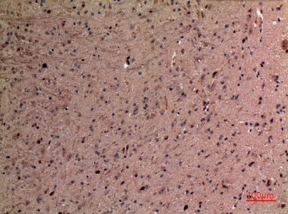 Fig.3. Immunohistochemical analysis of paraffin-embedded Mouse-brain, antibody was diluted at 1:100.
