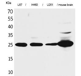 Fig.1. Western Blot analysis of U87, H460, U251,  Mouse brain cells using UCH-L1 Polyclonal Antibody. Secondary antibody (catalog#: A21020) was diluted at 1:20000.