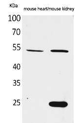 Fig.1. Western Blot analysis of Mouse heart, Mouse kidney cells using Sg III Polyclonal Antibody. Secondary antibody (catalog#: A21020) was diluted at 1:20000.