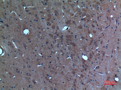 Fig.3. Immunohistochemical analysis of paraffin-embedded rat-brain, antibody was diluted at 1:100.