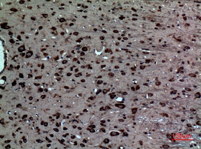 Fig.2. Immunohistochemical analysis of paraffin-embedded rat-brain, antibody was diluted at 1:100.